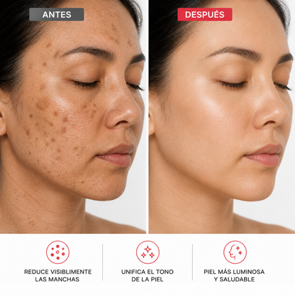 ClearSkin™ – Deja atrás las manchas y recupera tu piel