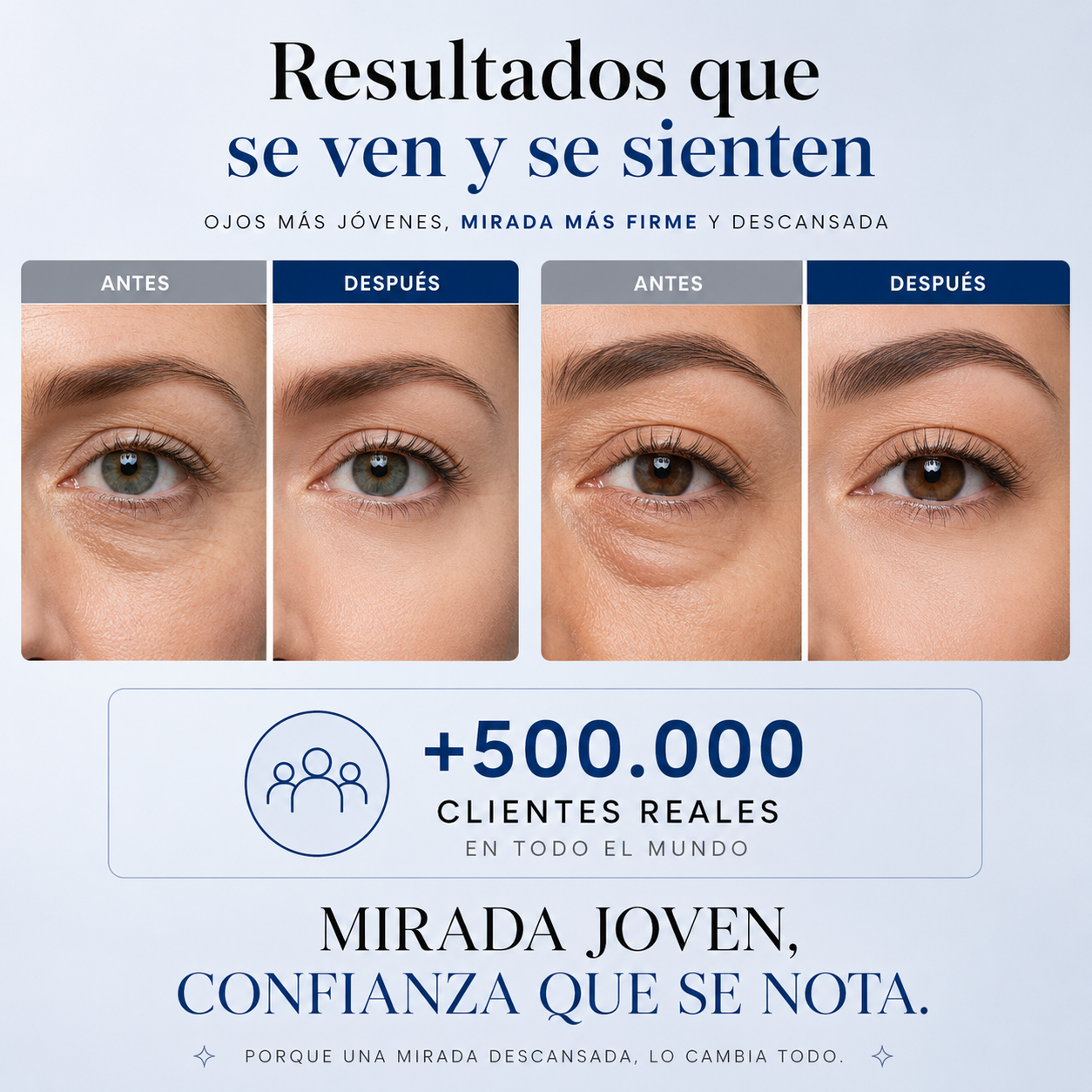 Eye Lift™ — Tratamiento tensor para el contorno de ojos
